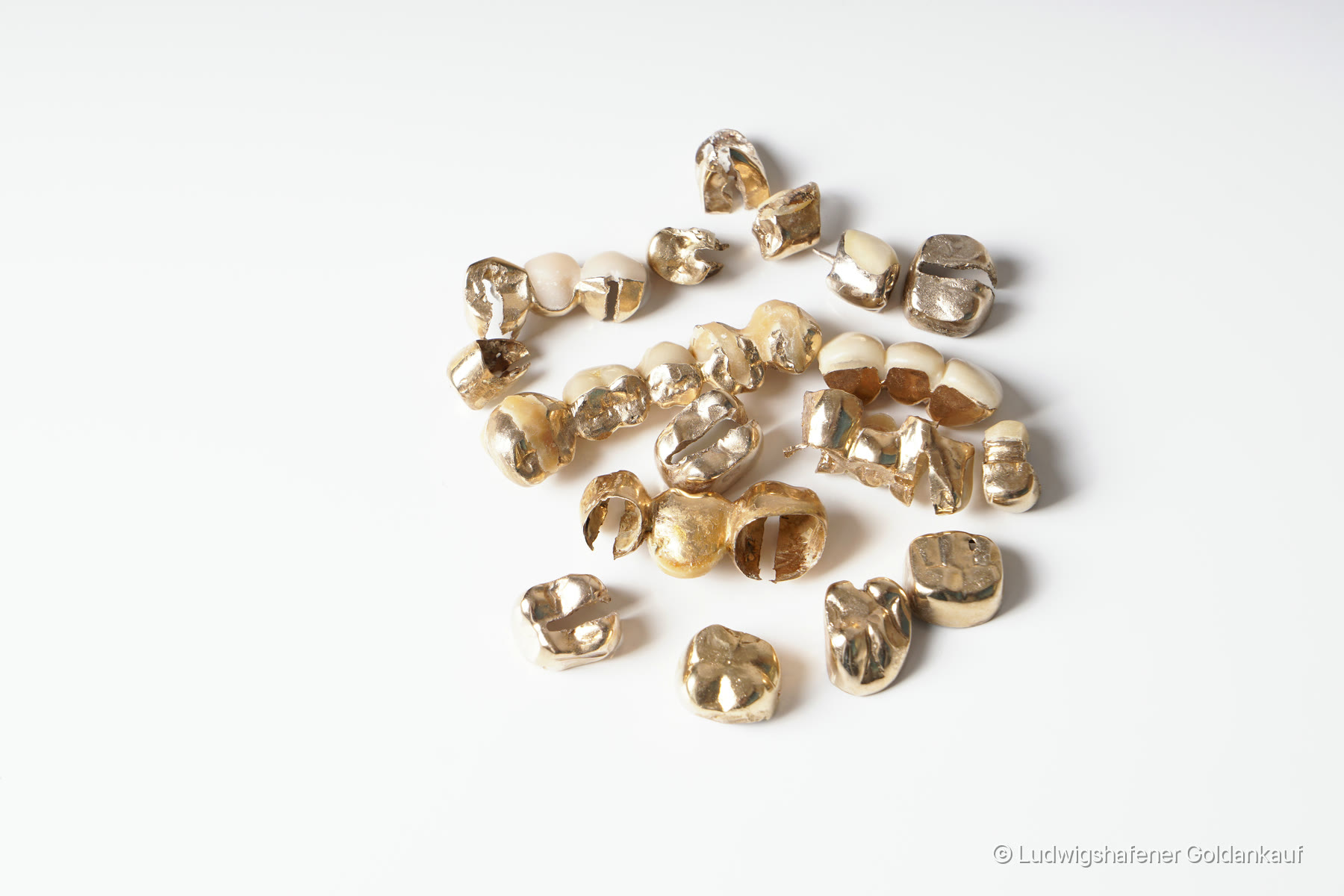 Zahngold und Dentalmaterial auf heller Fläche